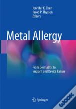 Metal Allergy