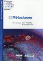 Metastases - Preview