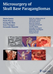 Capa do artigo Microsurgery Of Skull Base Paragangliomas