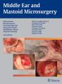 Middle Ear And Mastoid Microsurgery - Preview