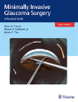 Minimally Invasive Glaucoma Surgery - Preview