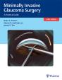 Minimally Invasive Glaucoma Surgery - Preview