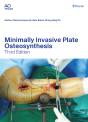 Minimally Invasive Plate Osteosynthesis - Preview