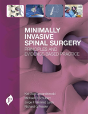 Minimally Invasive Spinal Surgery - Preview