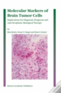 Capa do artigo Molecular Markers Of Brain Tumor Cells