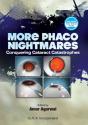 More Phaco Nightmares - Preview