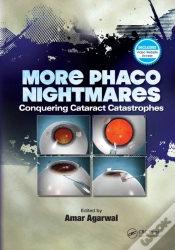 Capa do artigo More Phaco Nightmares