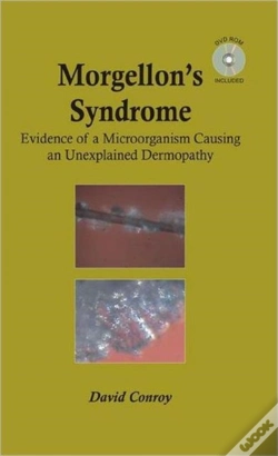 Capa do artigo Morgellon'S Syndrome