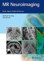 Mr Neuroimaging - Preview