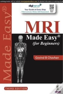 Capa do artigo Mri Made Easy (For Beginners)