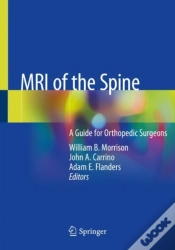 Capa do artigo Mri Of The Spine