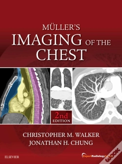 Capa do artigo Muller'S Imaging Of The Chest E-Book