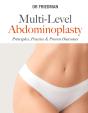 Multi-Level Abdominoplasty - Preview