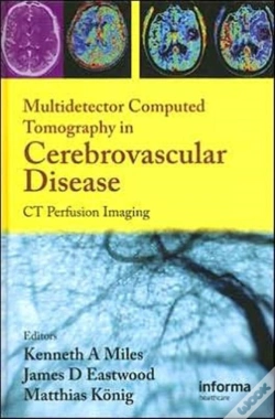 Capa do artigo Multidetector Computed Tomography In Cerebrovascular Disease