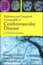 Multidetector Computed Tomography In Cerebrovascular Disease - Preview