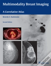 Multimodality Breast Imaging