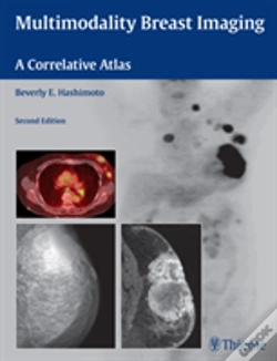 Capa do artigo Multimodality Breast Imaging