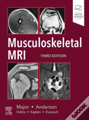 Capa do artigo Musculoskeletal Mri E-Book
