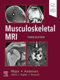 Musculoskeletal Mri E-Book - Preview