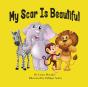 My Scar Is Beautiful - Preview