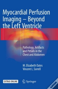 Capa do artigo Myocardial Perfusion Imaging - Beyond The Left Ventricle