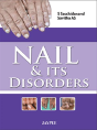 Nail & Its Disorders - Preview