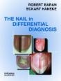 Nail In Differential Diagnosis - Preview