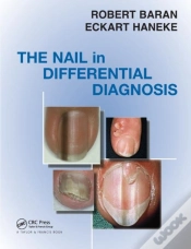Capa do artigo Nail In Differential Diagnosis