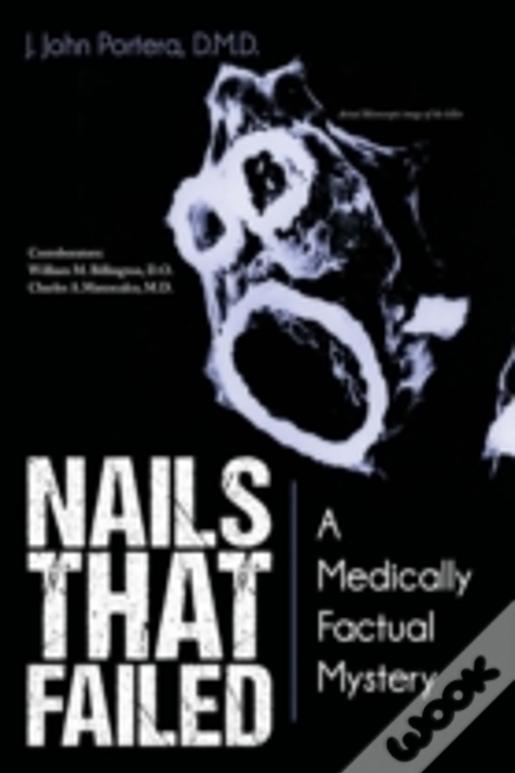 Nails That Failed: A Medically Factual Mystery