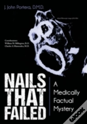 Nails That Failed: A Medically Factual Mystery