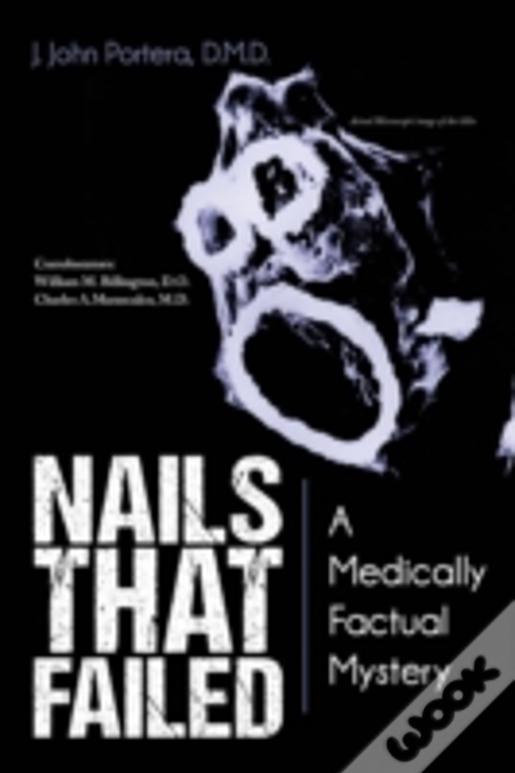 Nails That Failed: A Medically Factual Mystery