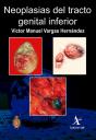 Neoplasias Del Tracto Genital Inferior - Preview