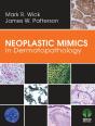 Neoplastic Mimics In Dermatopathology - Preview