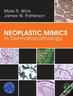Capa do artigo Neoplastic Mimics In Dermatopathology