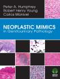 Neoplastic Mimics In Genitourinary Pathology - Preview