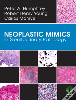 Capa do artigo Neoplastic Mimics In Genitourinary Pathology
