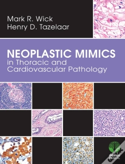 Capa do artigo Neoplastic Mimics In Thoracic And Cardiovascular Pathology