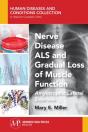 Nerve Disease Als And Gradual Loss Of Muscle Function - Preview