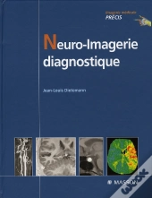 Neuro-Imagerie Diagnostique