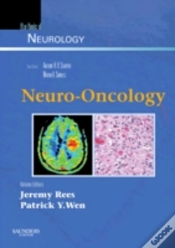 Capa do artigo Neuro-Oncology