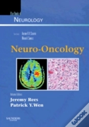Capa do artigo Neuro-Oncology