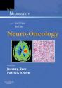 Neuro-Oncology - Preview