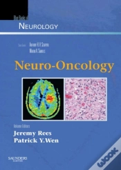 Capa do artigo Neuro-Oncology