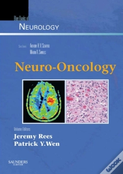 Capa do artigo Neuro-Oncology
