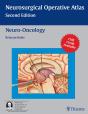 Neuro-Oncology - Preview
