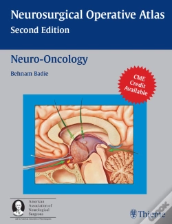 Capa do artigo Neuro-Oncology