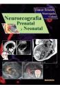 Neuroecografia Prenatal Y Neonatal - Preview