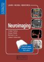 Neuroimaging - Preview