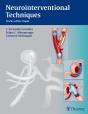 Neurointerventional Techniques - Preview