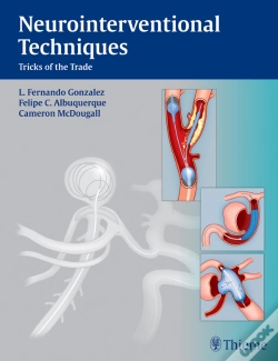 Capa do artigo Neurointerventional Techniques